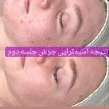 فیشیال/پاکسازی پوست