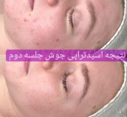 فیشیال/پاکسازی پوست